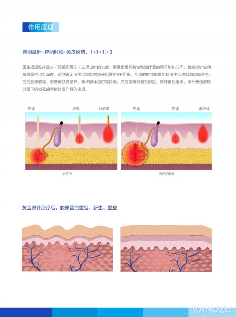 彩頁-第4代黃金微針4